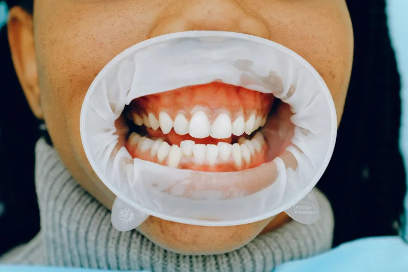 The Hidden Connection Between Your Gums and Your Brain